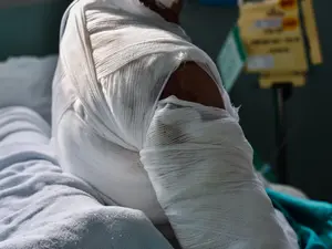 19-Year-Old Set Ablaze in Brutal Family Feud