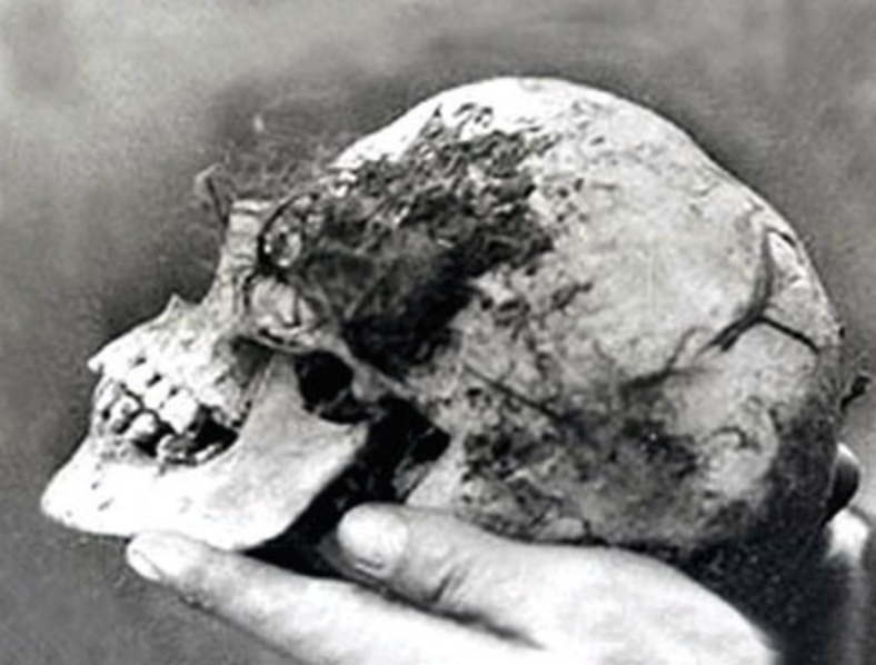 Who Was The Murdered Woman in the Wych Elm? A 75-Year-Old Mystery Unveiled-2