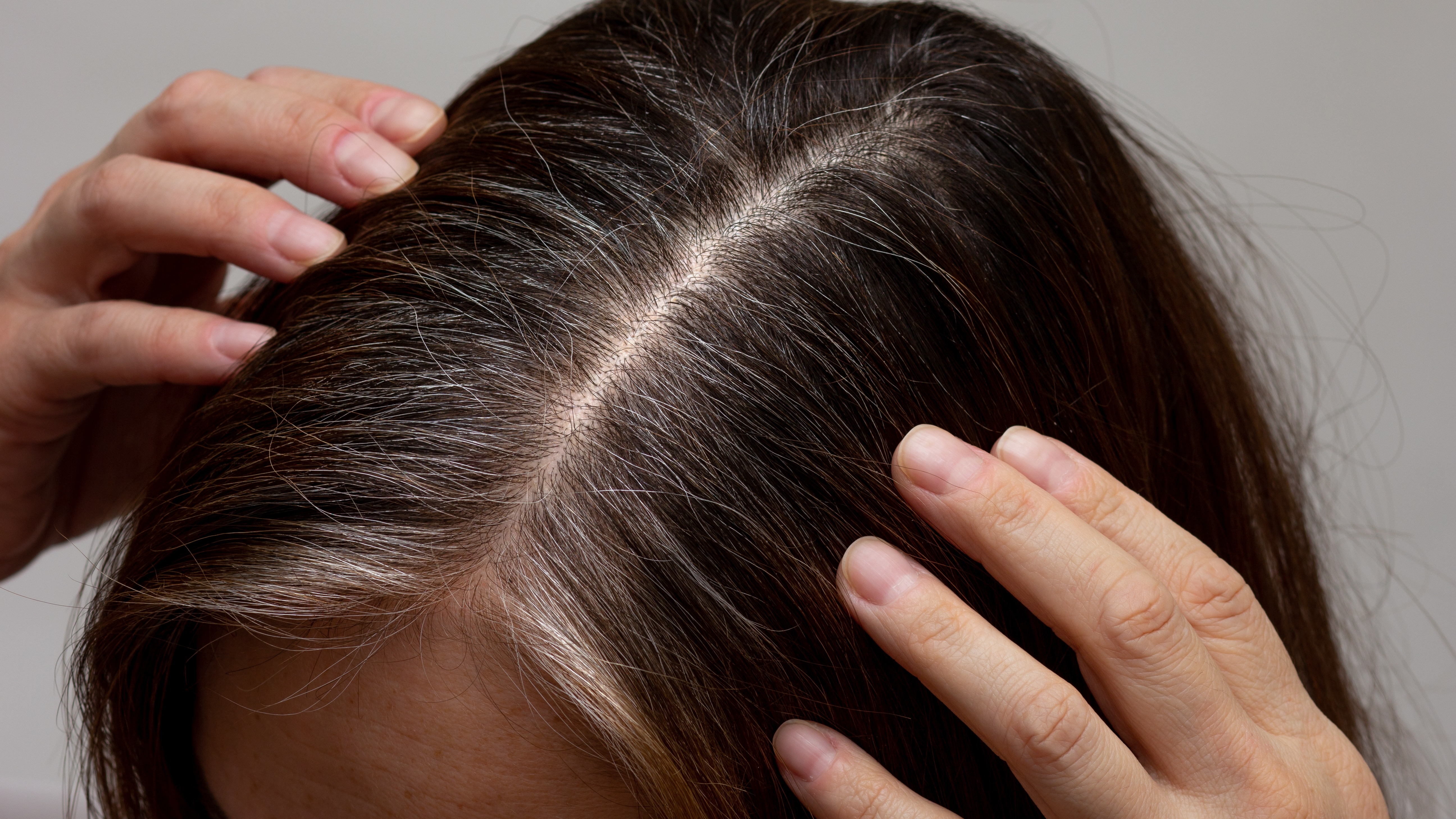 Gray Hair Might Be Reversible - and It's Not Sci-Fi-1