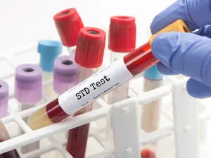 STD Fight Ends in Tragedy