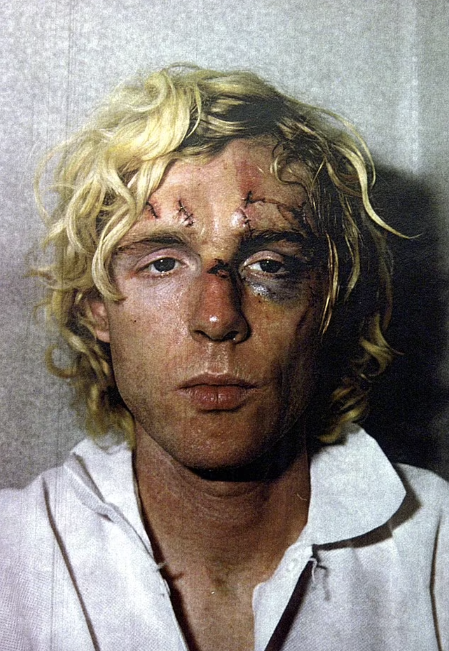 The Night George Harrison Fought for His Life in a Brutal Home Invasion- 2